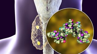 Sekundärer Hyperparathyreoidismus